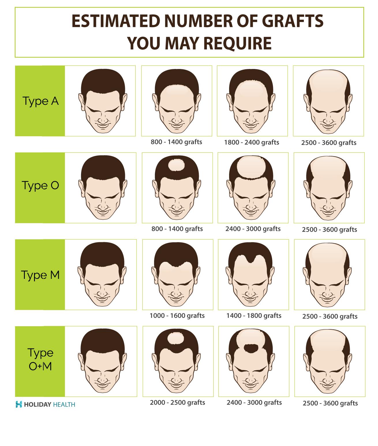 How Much Does a Hair Transplant Really Cost in 2025?