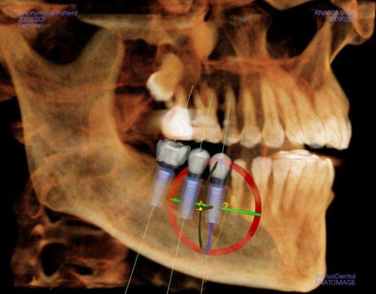 Navigating the Immediate Post-Surgery Phase: What ​to Expect