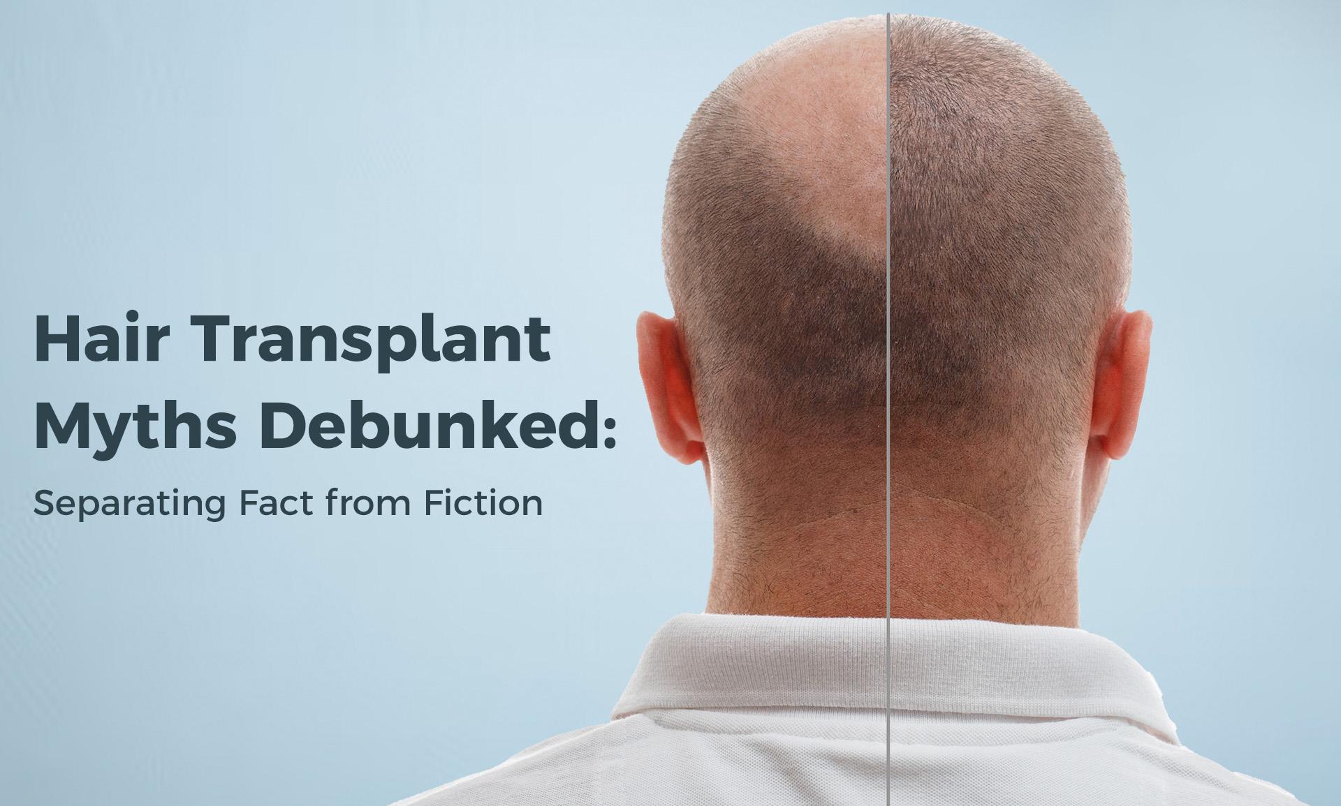 Debunking Common Myths About Recovery ‍and⁢ Results